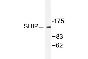 Image no. 1 for anti-Inositol Polyphosphate-5-Phosphatase, 145kDa (INPP5D) antibody (ABIN271812)