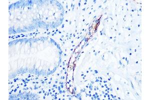 Immunohistochemistry of paraffin-embedded human appendix using CD62P/P-selectin Rabbit mAb (ABIN7270190) at dilution of 1:100 (40x lens).