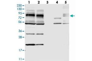Western blot analysis of Lane 1: RT-4, Lane 2: U-251 MG, Lane 3: Human Plasma, Lane 4: Liver, Lane 5: Tonsil with MAK10 polyclonal antibody . (MAK10/NAA35 antibody)