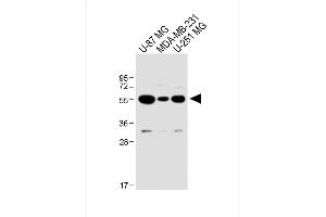All lanes : Anti-USP17L24 Antibody (C-term) at 1:1000 dilution Lane 1: U-87 MG whole cell lysate Lane 2: MDA-MB-231 whole cell lysate Lane 3: U-251 MG whole cell lysate Lysates/proteins at 20 μg per lane. (USP17L24 antibody  (C-Term))