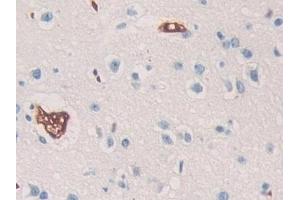 Immunohistochemistry (IHC) image for anti-SHC (Src Homology 2 Domain Containing) Transforming Protein 3 (SHC3) (AA 188-433) antibody (ABIN7443536)