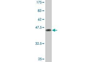 Western Blot detection against Immunogen (46. (Dual Specificity Phosphatase 3 (DUSP3) (AA 1-185) antibody)