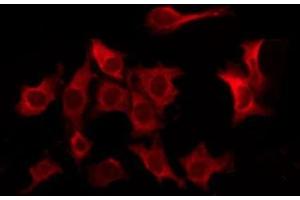 ABIN6277854 staining Hela by IF/ICC. (FCGR2B antibody  (C-Term))