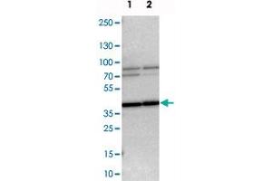 Western blot analysis of cell lysates with WBSCR17 polyclonal antibody .