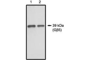 Image no. 1 for anti-Guanine Nucleotide Binding Protein (G Protein), beta 5 (GNB5) antibody (ABIN265062) (GNB5 antibody)