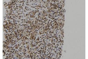 ABIN6273013 at 1/100 staining Human spleen tissue by IHC-P. (PTPN23 antibody  (C-Term))