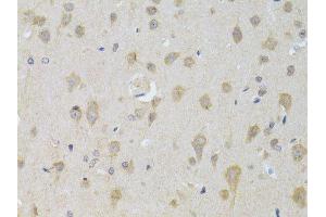 Immunohistochemistry of paraffin-embedded rat brain using ATG13 antibody.