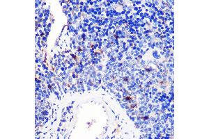 Immunohistochemistry of paraffin-embedded Mouse spleen using 4-1BB/CD137 Rabbit pAb (ABIN7271073) at dilution of 1:100 (40x lens). (CD137 antibody  (AA 150-250))