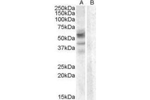 ABIN2561230 (0. (Arylsulfatase D antibody  (Internal Region))