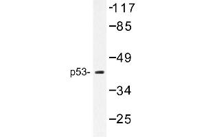Image no. 1 for anti-Tumor Protein P53 (TP53) antibody (ABIN272156) (p53 antibody)