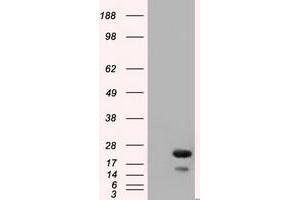 Western Blotting (WB) image for anti-RAB17, Member RAS Oncogene Family (RAB17) antibody (ABIN1500538) (RAB17 antibody)