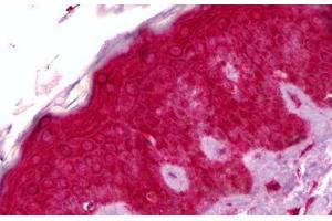 Anti-GPNMB antibody IHC staining of human skin.