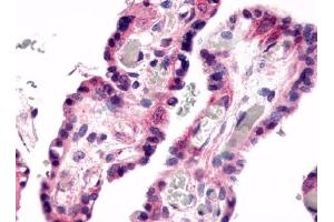 Immunohistochemical staining of Placenta (Villi) using anti- GPR78 antibody ABIN122184 (GPR78 antibody)