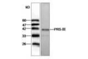 Image no. 1 for anti-phosphoribosyl Pyrophosphate Synthetase 1-Like 1 (PRPS1L1) antibody (ABIN791432) (PRPS1L1 antibody)