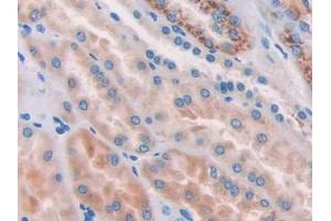 DAB staining on IHC-P; Samples: Human Kidney Tissue (Nicastrin antibody  (AA 420-655))