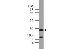 Image no. 1 for anti-Cytokine Receptor-Like Factor 2 (CRLF2) (AA 102-310) antibody (ABIN5027603)
