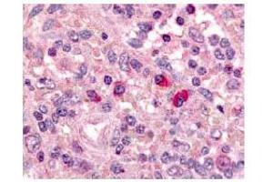 Immunohistochemical staining of ARTEMIS in Formalin fixed and Paraffin embeddes human spleen using antibody ABIN117935. (DCLRE1C antibody  (AA 482-495))