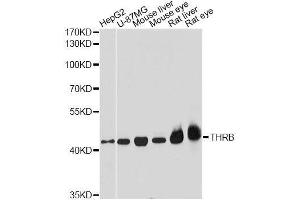 Western blot analysis of extracts of various cell lines, using THRB antibody. (THRB antibody  (AA 1-250))