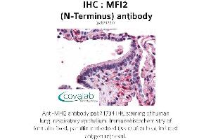Image no. 2 for anti-Antigen P97 (Melanoma Associated) Identified By Monoclonal Antibodies 133.2 and 96.5 (MFI2) (N-Term) antibody (ABIN1736928) (MFI2 antibody  (N-Term))