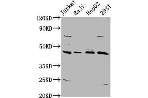 Western Blot Positive WB detected in: Jurkat whole cell lysate, Raji whole cell lysate, HepG2 whole cell lysate, 293T whole cell lysate All lanes: SPO11 antibody at 5. (SPO11 antibody  (AA 28-109))