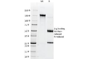 SDS-PAGE Analysis Purified CD147 Mouse Monoclonal Antibody (BSG/963). (CD147 antibody)