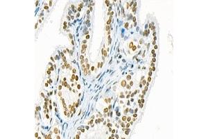 Immunohistochemistry analysis of paraffin-embedded rat ovary using,Mettl11a (ABIN7074612) at dilution of 1: 1500 (METTL11A antibody)