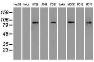 Image no. 1 for anti-Catenin (Cadherin-Associated Protein), beta 1, 88kDa (CTNNB1) (AA 531-781) antibody (ABIN1496902) (CTNNB1 antibody  (AA 531-781))