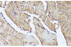 Immunohistochemistry of paraffin-embedded Mouse heart using HAL Polyclonal Antibody at dilution of 1:100 (40x lens). (HAL antibody)