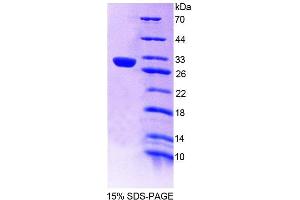 SDS-PAGE analysis of Rat PTPN14 Protein.