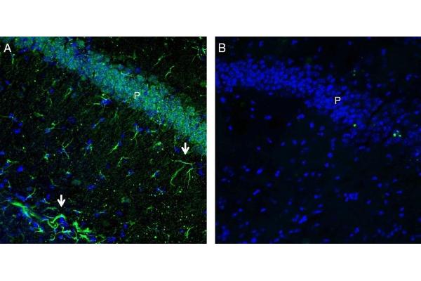 FFAR2 antibody  (C-Term, Intracellular)