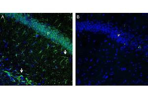 Expression of GPR43/FFAR2 in mouse hippocampus.