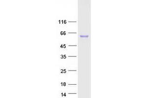 Cathepsin C (CTSC) (Transcript Variant 1) protein (Myc-DYKDDDDK Tag)