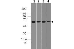 Image no. 1 for anti-DEAD (Asp-Glu-Ala-Asp) Box Polypeptide 41 (DDX41) (AA 30-240) antibody (ABIN5027142) (DDX41 antibody  (AA 30-240))