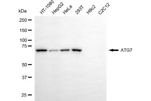 Western blotting analysis using ATG7 antibody (ABIN7797675). (Recombinant ATG7 antibody)