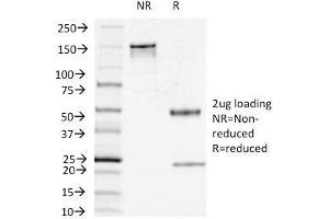 SDS-PAGE Analysis Purified Thymidine Phosphorylase / PD-ECGF Mouse Monoclonal Antibody (P-GF. (Thymidine Phosphorylase antibody)