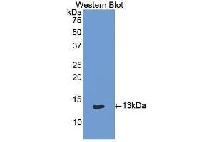 Western Blotting (WB) image for anti-Keratin 1 (KRT1) (AA 489-625) antibody (ABIN1859571) (Cytokeratin 1 antibody  (AA 489-625))