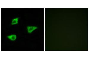 Immunofluorescence analysis of LOVO cells, using CHRM4 antibody. (CHRM4 antibody  (Internal Region))