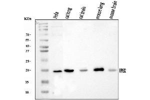 Western blot analysis of RPL32 using anti-RPL32 antibody (ABIN7601826).