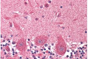 Human Brain, Cerebellum (formalin-fixed, paraffin-embedded) stained with DCTN1 antibody ABIN337005 at 2. (Dynactin 1 antibody  (AA 1266-1278))