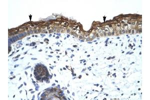 SMARCA2 antibody was used for immunohistochemistry at a concentration of 4-8 ug/ml to stain Squamous epithelial cells (arrows) in Human Skin. (SMARCA2 antibody  (Middle Region))
