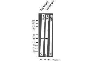 Western blot analysis of EFNB2 expression in various lysates (Ephrin B2 antibody  (C-Term))