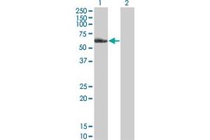 Western Blot analysis of NR2C2 expression in transfected 293T cell line by NR2C2 monoclonal antibody (M01), clone 2A5.