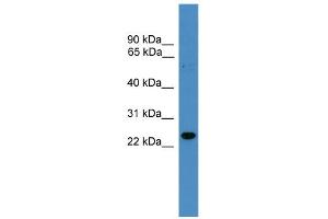 WB Suggested Anti-RAB9B Antibody Titration: 0. (RAB9B antibody  (N-Term))