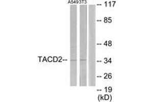 Western blot analysis of extracts from A549/NIH-3T3 cells, using TACD2 Antibody. (TACSTD2 antibody  (AA 131-180))