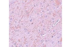 Immunohistochemical staining of rat brain tissue with PIAS2 polyclonal antibody  at 5 ug/mL dilution.