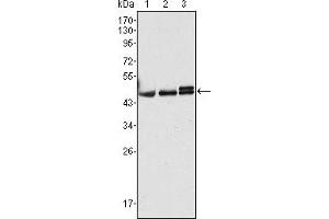 Western blot analysis using CK17 mouse mAb against Hela (1), MCF-7 (2) and A431 (3) cell lysate. (KRT17 antibody)