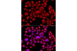 Immunofluorescence analysis of  cells using PIP4K2B antibody (ABIN6130646, ABIN6145675, ABIN6145677 and ABIN6216199). (PIP4K2B antibody  (AA 1-270))