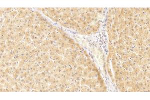 Detection of IL1a in Human Liver Tissue using Polyclonal Antibody to Interleukin 1 Alpha (IL1a) (IL1A antibody  (AA 113-271))