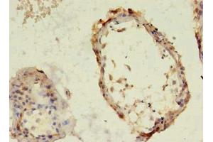 Immunohistochemistry of paraffin-embedded human testis tissue using ABIN7171610 at dilution of 1:100