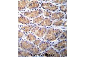 TOR2A Antibody (Center) immunohistochemistry analysis in formalin fixed and paraffin embedded human stomach tissue followed by peroxidase conjugation of the secondary antibody and DAB staining. (TOR2A antibody  (Middle Region))